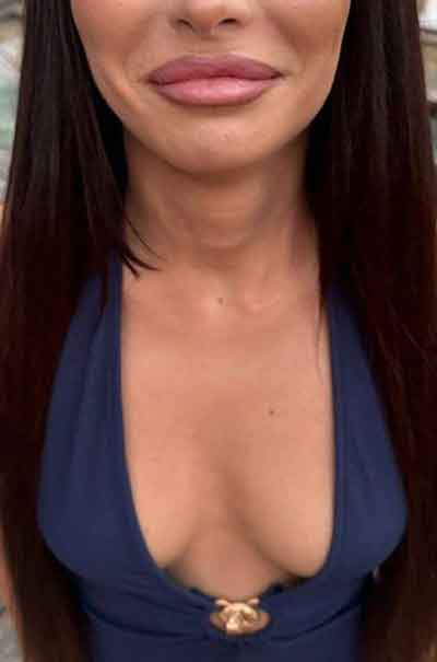 Hanna, 42 år